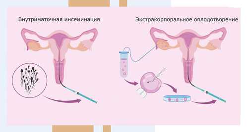 Обучение технике самостоятельного применения